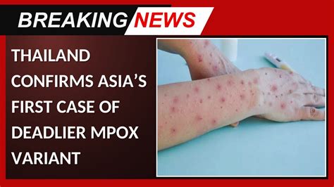 asia m pornhub|New, deadlier mpox found in Thailand: These Asian nations have .